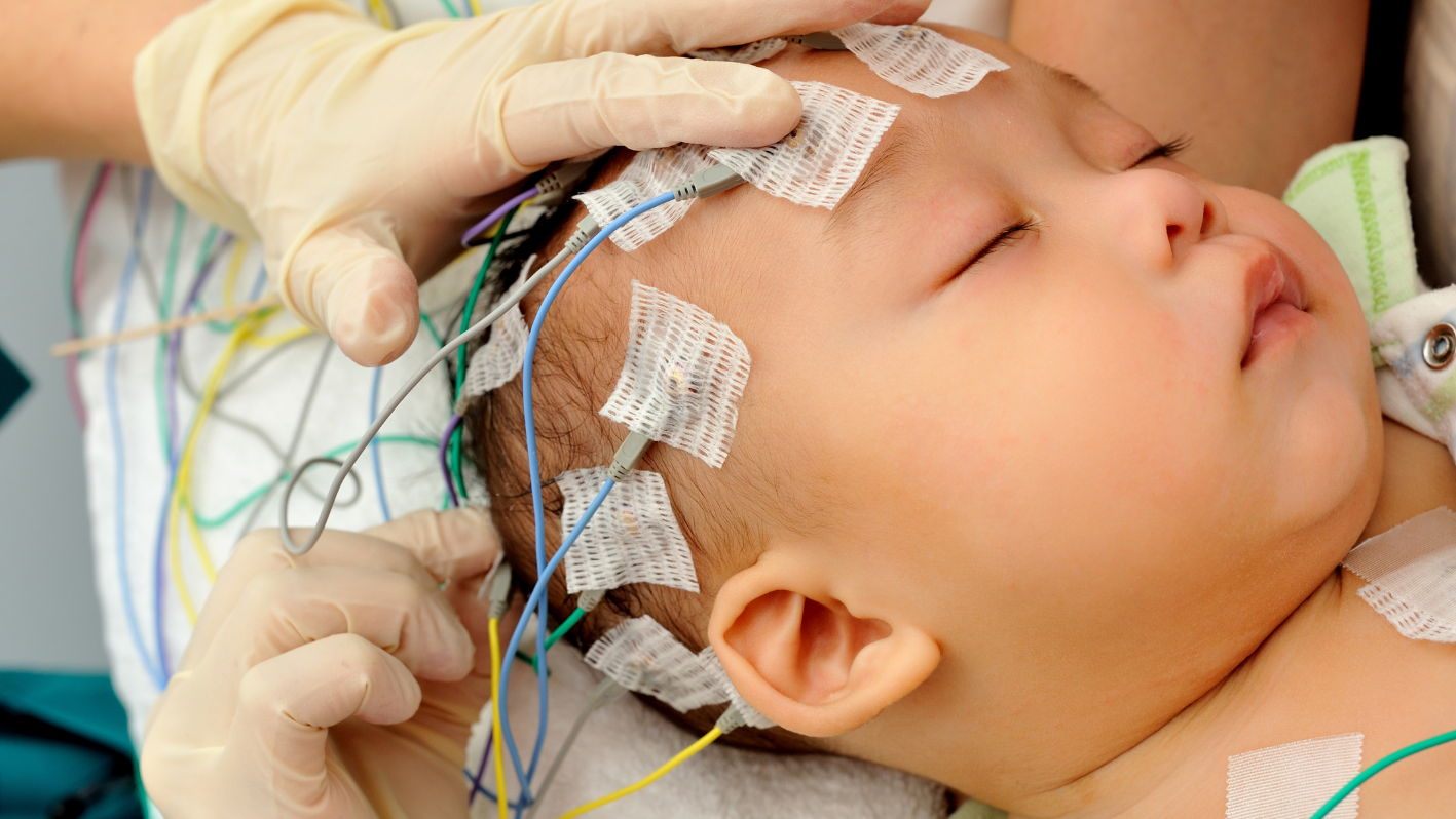 Anwendung von Elektroden-Kontaktspray von ratiomed am Kopf eines Babys bei einem EEG